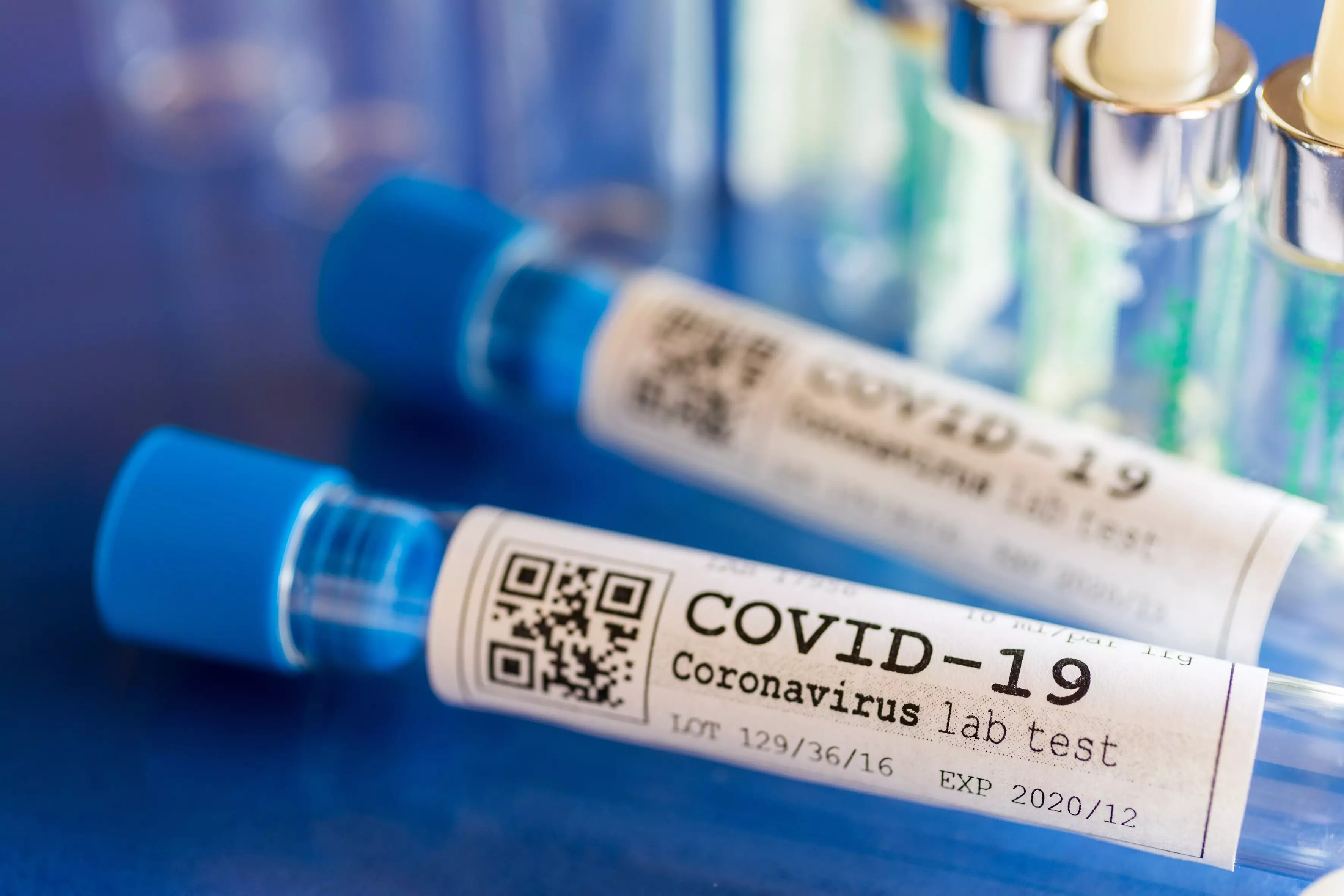 Ölkədə neçə nəfər koronavirusa yoluxub?