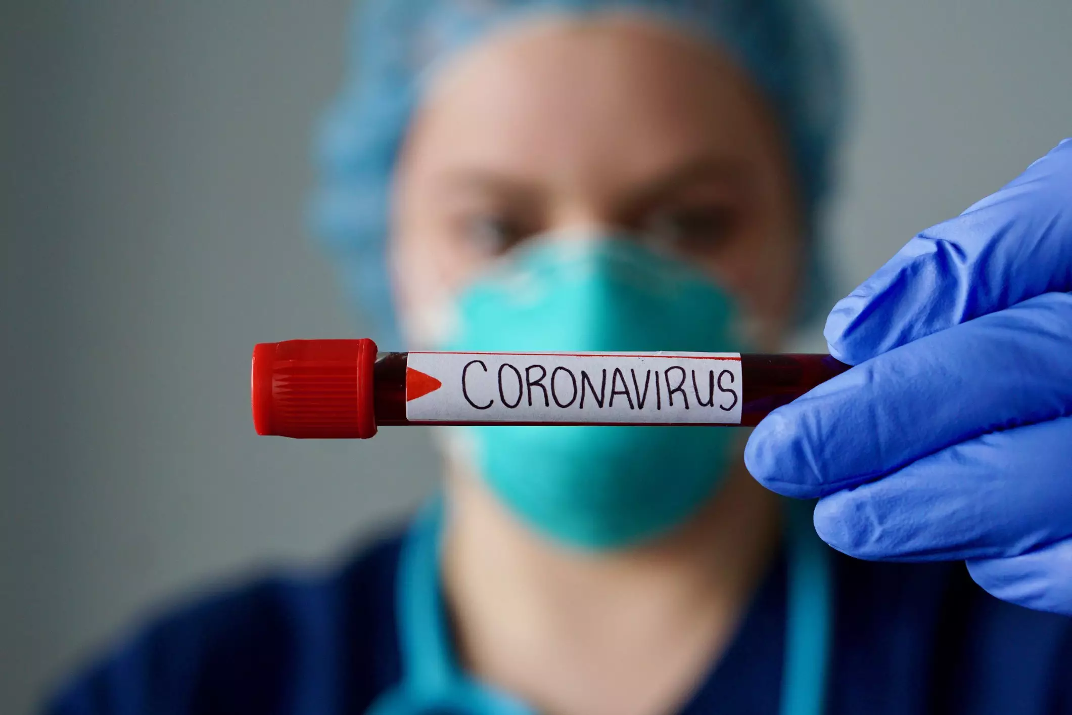 Dünyada koronavirusa yoluxma halı 63% artıb