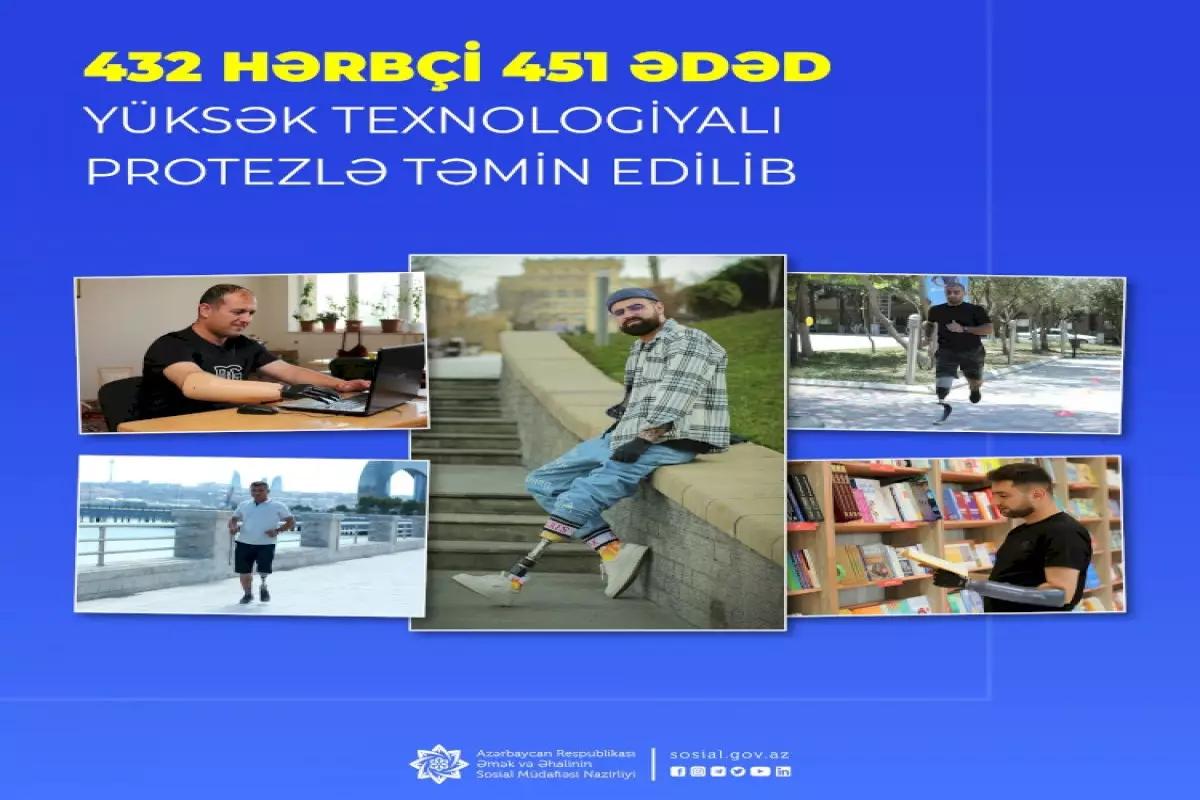 432 hərbçi yüksək texnologiyalı protezlə təmin edilib