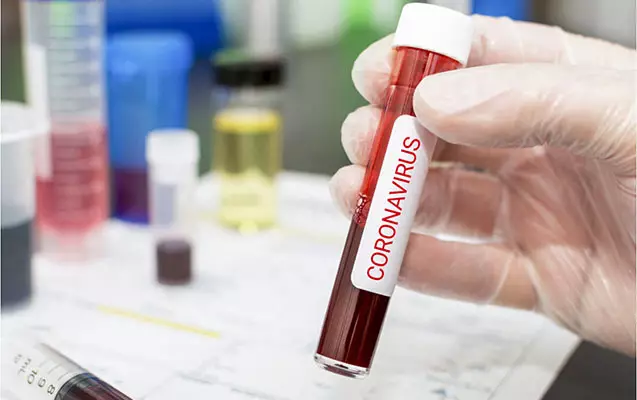 Azərbaycanda son sutkada koronavirusa 14 yeni yoluxma faktı qeydə alınıb