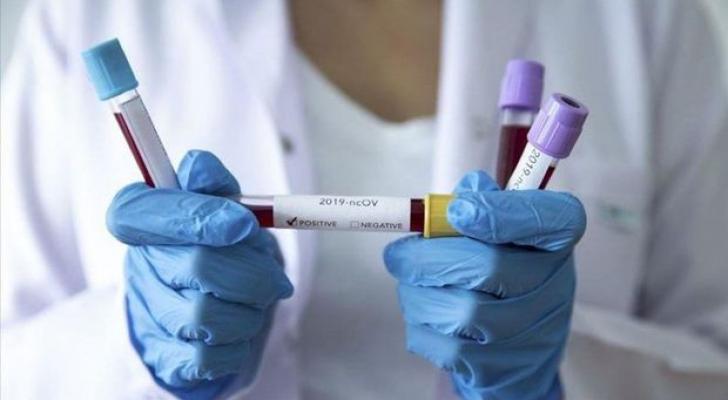 Azərbaycanda daha bir nəfər koronavirusdan öldü – 25 yeni yoluxma aşkarlandı