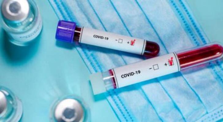 Daha 67 nəfər koronavirusdan sağaldı - RƏSMİ