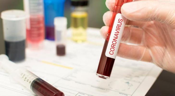 İspaniyada koronavirusdan ölənlərin sayında rekord azalma