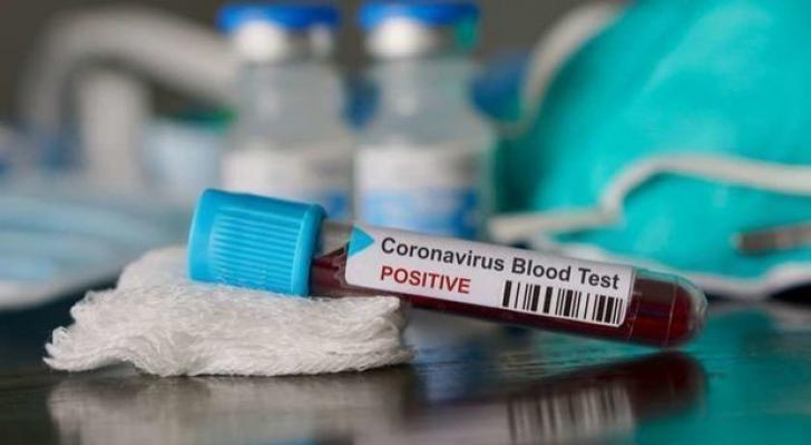 Dünyada 3,3 milyon insan koronavirusa yoluxub