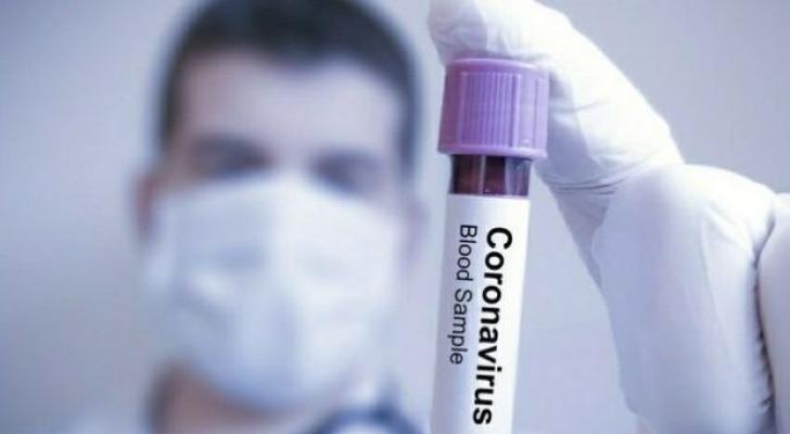 Dünyada 1,2 milyondan çox insan koronavirusdan sağaldı