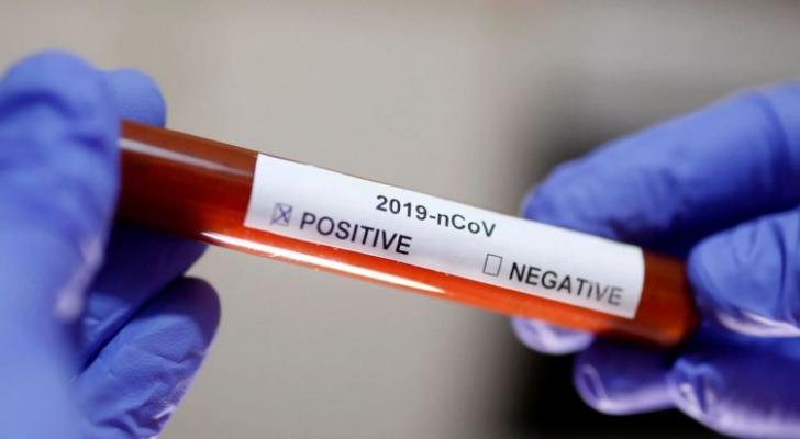 Qırğızıstanda daha 24 nəfər koronavirusa yoluxub