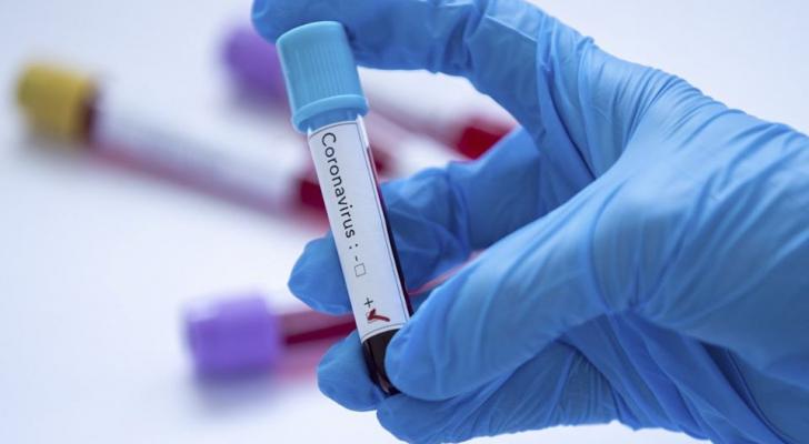 Qırğızıstanda 27 nəfər yeni növ koronavirusa yoluxub