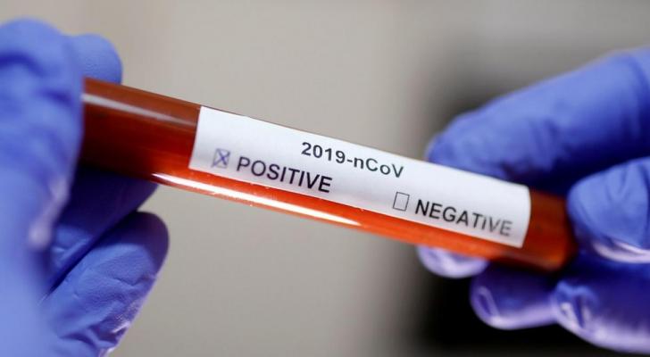 Almaniyada bir gündə koronavirusa 745 yoluxma qeydə alındı