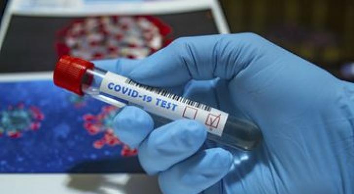 Gürcüstanda koronavirusa yoluxanların sayı 723-ə çatdı