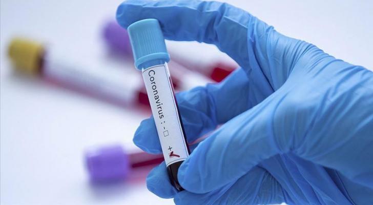 Azərbaycanda daha iki nəfər koronavirusdan öldü: 149 yeni yoluxma - RƏSMİ