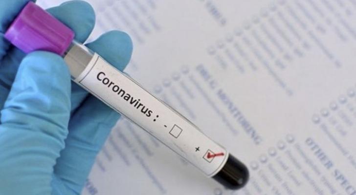 Dünyada koronavirusdan ölənlərin sayı 350 mini ötdü