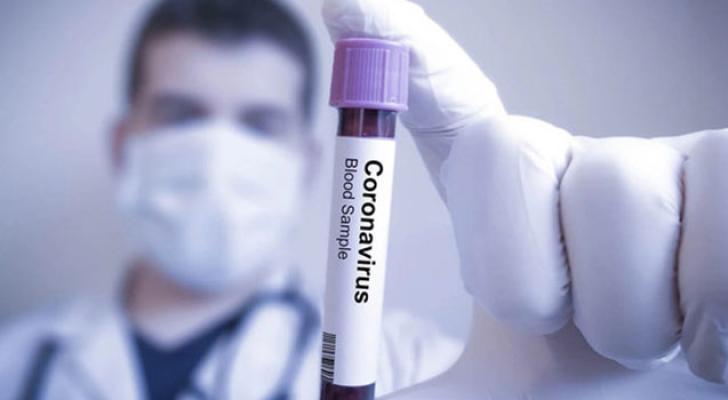 Kürdəmirdə daha beş nəfər koronavirusa yoluxdu