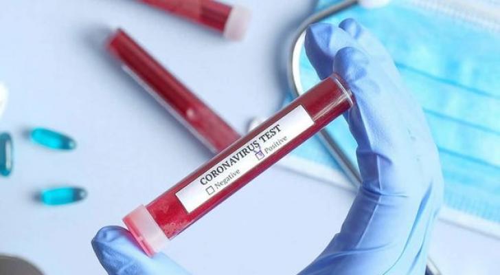 Gürcüstanda koronavirusa 735 nəfər yoluxub
