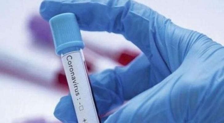 Dünyada koronavirusdan sağalanların sayı 2,5 milyonu keçdi
