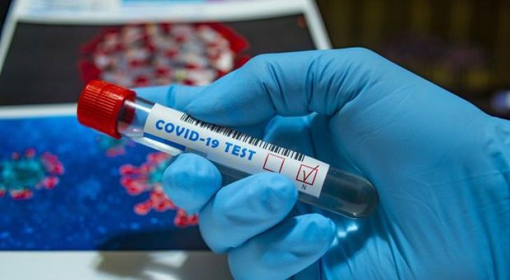 Azərbaycanda daha iki nəfər koronavirusdan öldü, 230 yeni yoluxma - RƏSMİ