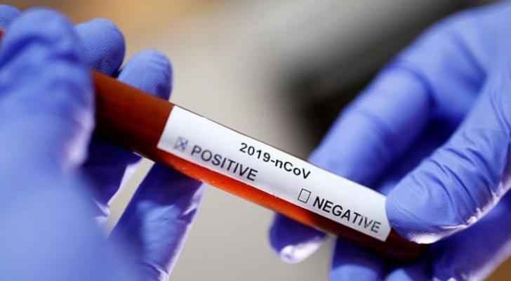 Rusiyada son sutkada 181 nəfərin koronavirusdan ölüb