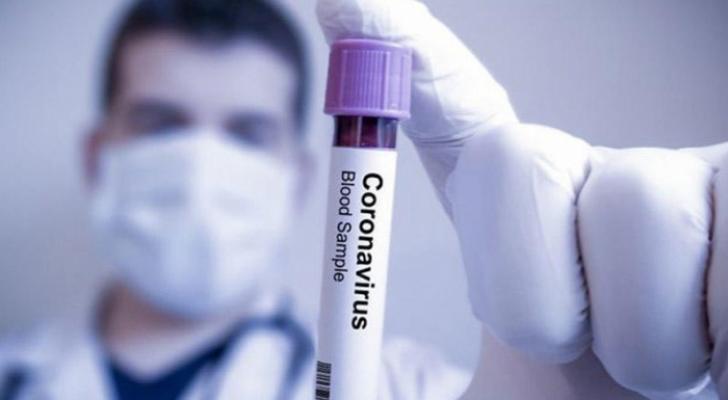 ÜST: Dünyada koronavirus qurbanlarının sayı 371 mini ötüb