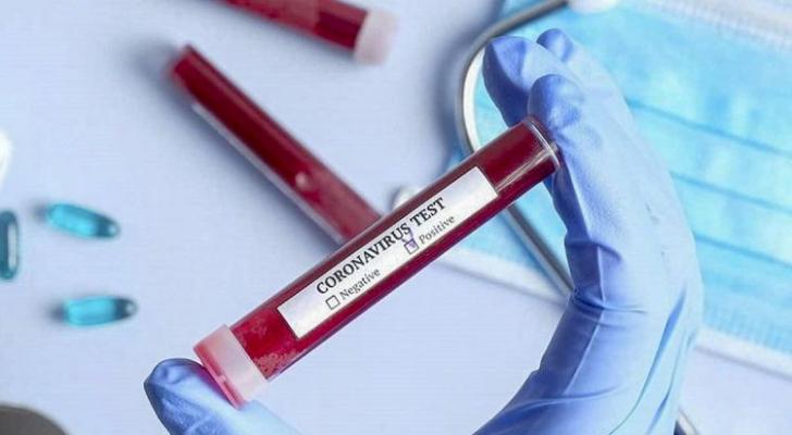 Moskvada daha 58 nəfər koronavirusdan ölüb