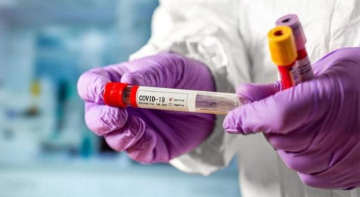 “Zeytun Pharmaceuticals” şirkəti Səhiyyə Nazirliyinə təmənnasız 50 000 PZR koronavirus test dəsti təqdim etdi