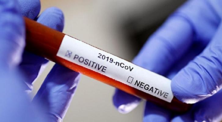 Ukraynada koronavirusa yoluxanların sayı 28 mini ötdü