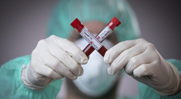 Azərbaycanda daha 336 nəfər koronavirusa yoluxub, 5 nəfər ölüb