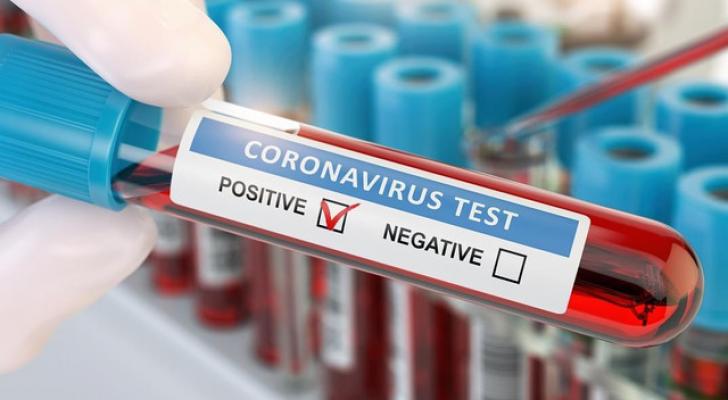 Azərbaycanda daha 338 nəfər koronavirusa yoluxub, 4 nəfər vəfat edib