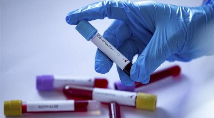 Azərbaycanda daha 491 nəfər koronavirusa yoluxub, 6 nəfər vəfat edib