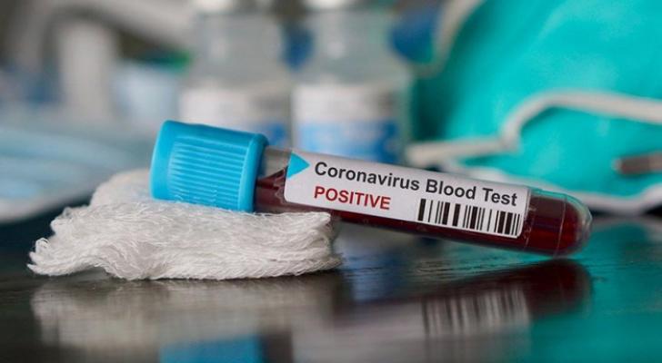 Dünyada koronavirusa yoluxanların sayı doqquz milyonu keçdi