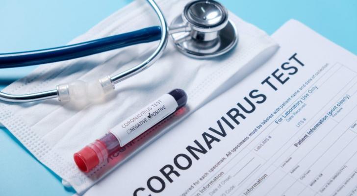 Daha bir icra başçısının müavini koronavirusa yoluxdu