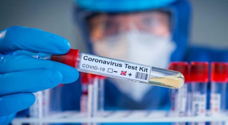 Azərbaycanda daha 590 nəfər koronavirusa yoluxub, 7 nəfər vəfat edib