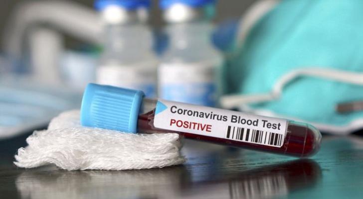 Daha altı nəfər koronavirusdan öldü: 547 yeni yoluxma