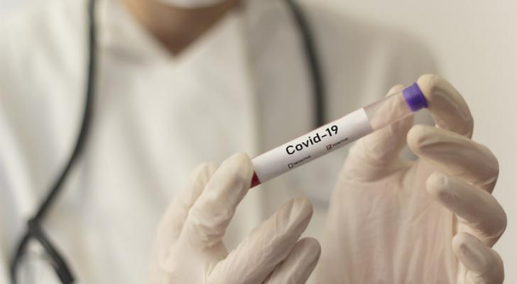 Yaponiyada koronavirusa yoluxanların sayı 19 mini ötdü