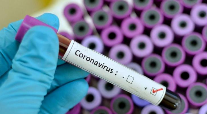 ABŞ-da yaşayan azərbaycanlı koronavirusdan öldü