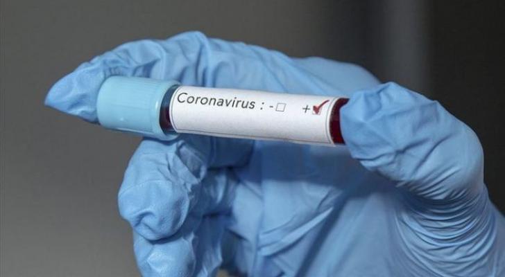 Braziliyada son sutkada koronavirusdan 1 000-ə yaxın insan ölüb