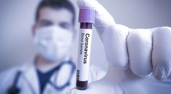 Dünyada koronavirusa yoluxanların sayı 10 milyon nəfəri ötüb