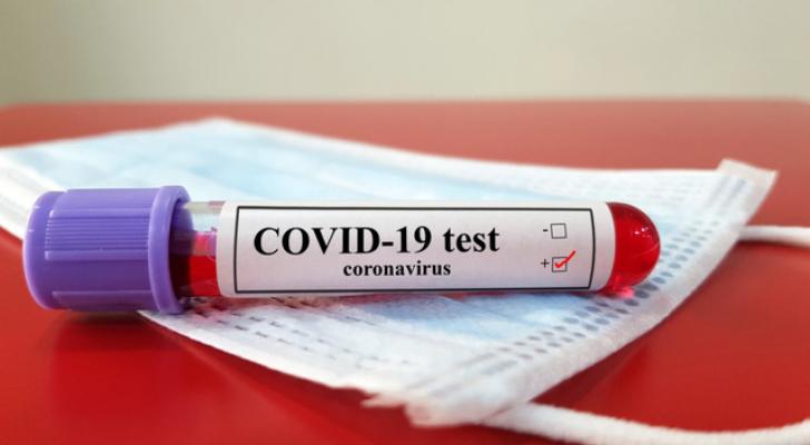 Koronavirus testindən keçmək istəyənlərin NƏZƏRİNƏ