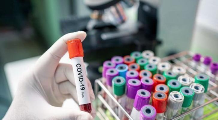 Naxçıvanda koronavirusa yoluxma qeydə alınmadı - Ölkə üzrə son STATİSTİKA