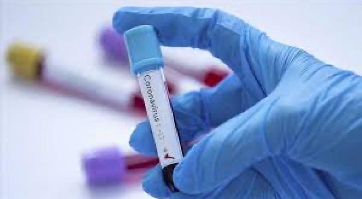 Azərbaycanda daha səkkiz nəfər koronavirusdan öldü: 526 yeni yoluxma - FOTO