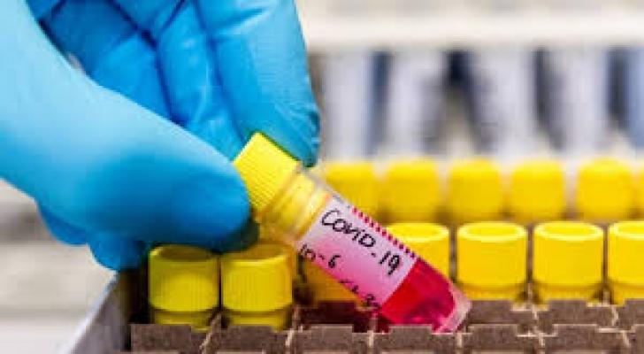 Rumıniyada koronavirusa yoluxanların sayı 35 mini ötdü