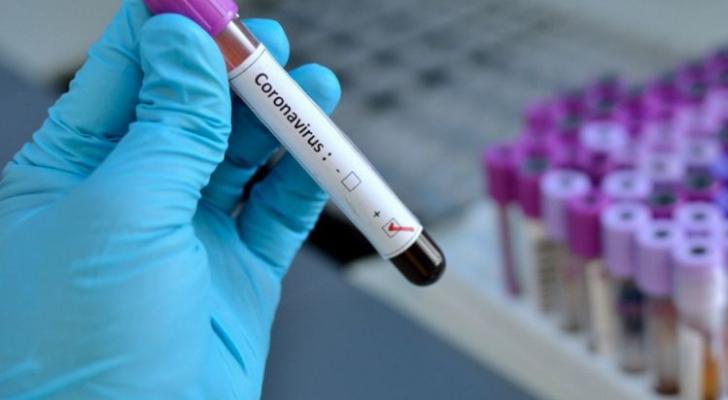 Dünyada koronavirusa yoluxanların sayı 15 milyonu ötdü