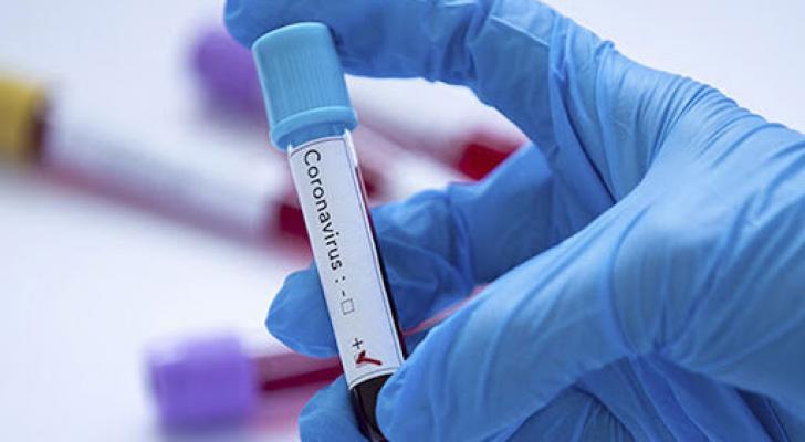 “25-26 iyulda koronavirus testlərinin cavabları səhv göndərilib” - RƏSMİ