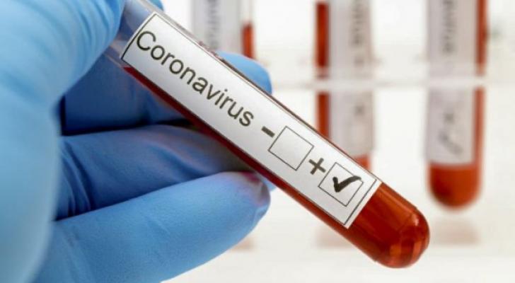 Azərbaycanda ümumilikdə 698 815 koronavirus testi aparılıb
