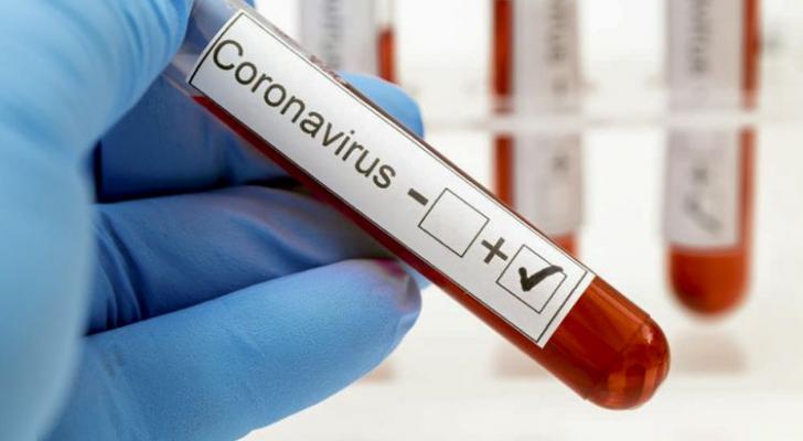 Koronavirusdan sağalanlarda yeni fəsad müşahidə edilib
