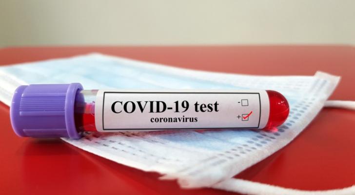 Ermənistanda koronavirusa yoluxanların sayı 39 mini ötdü