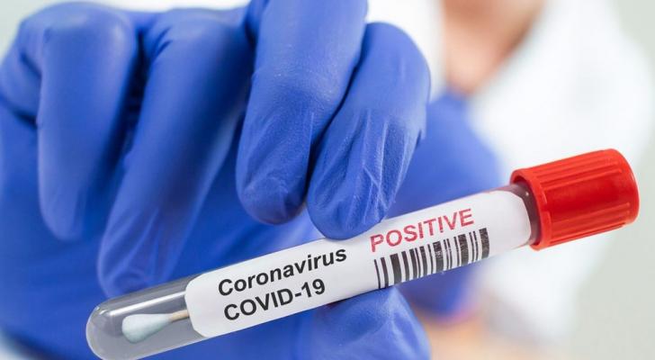Rusiyada koronavirusa yoluxanların sayı 860 mini ötdü