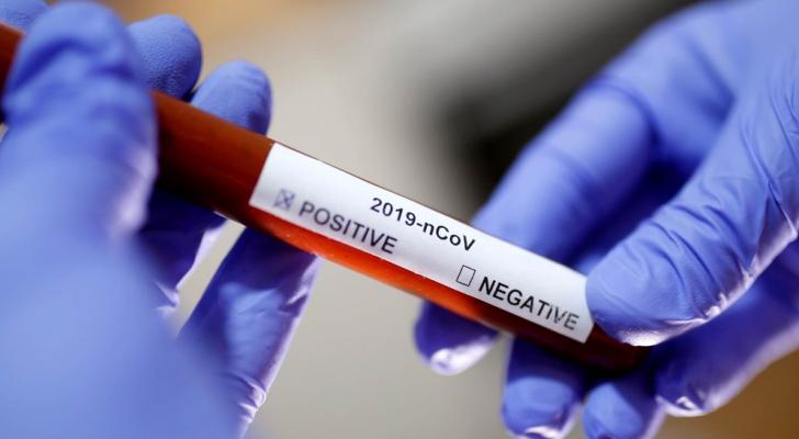 Gürcüstanda koronavirusa yoluxanların sayı 25 nəfər artdı
