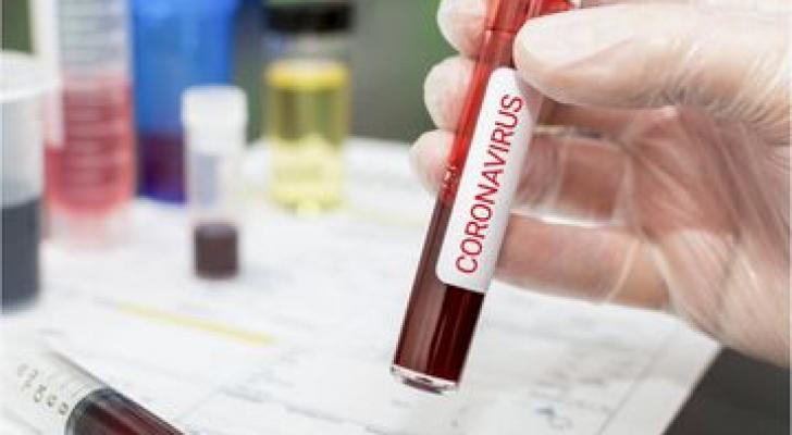 Ukraynada koronavirusa yoluxanların sayı 100 mini ötdü