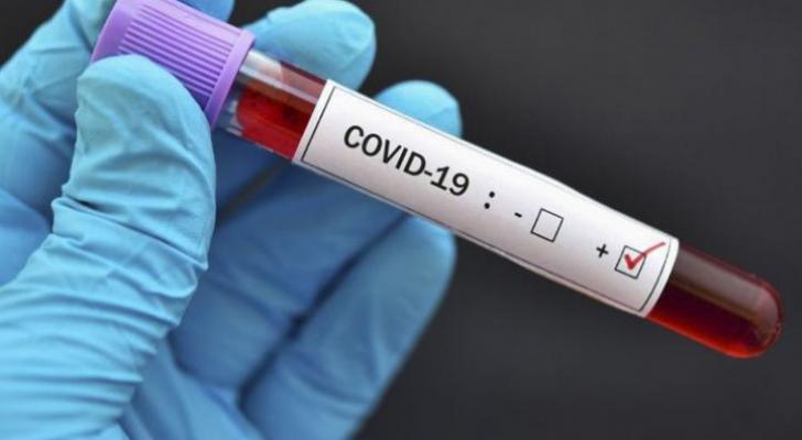 Daha iki nəfər koronavirusdan öldü: 135 yeni yoluxma - FOTO