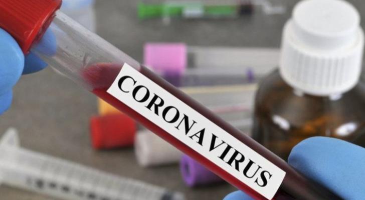 Rusiyada koronavirusdan ölənlərin sayı 19 mini ötüb