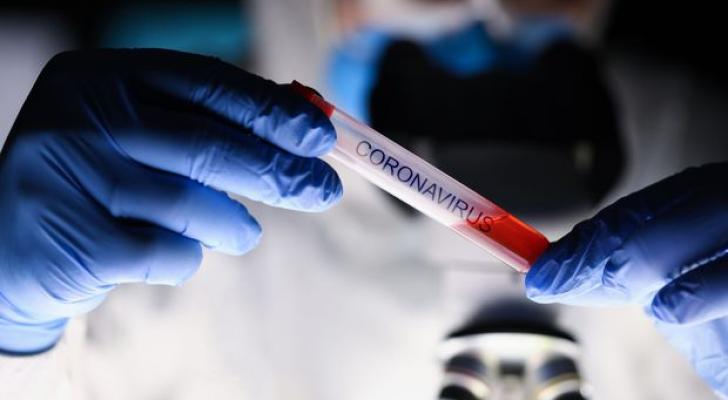 Daha iki nəfər koronavirusdan öldü: 58 yeni yoluxma - FOTO